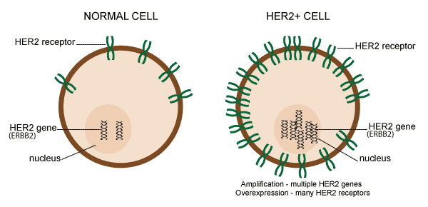 HER2+ Breast Cancer Cells have multiple ERBB2 Genes And HER2 Receptors.