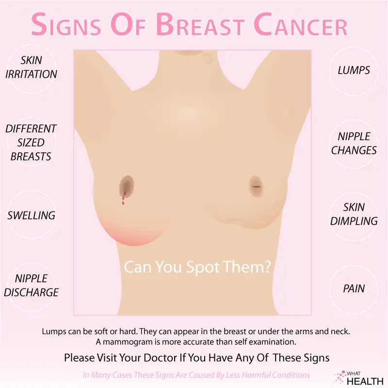 The Signs Of Breast Cancer