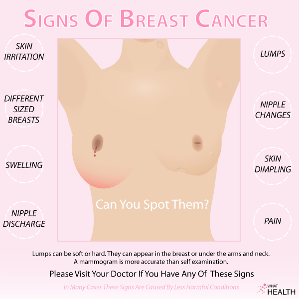 Signs Of Breast Cancer