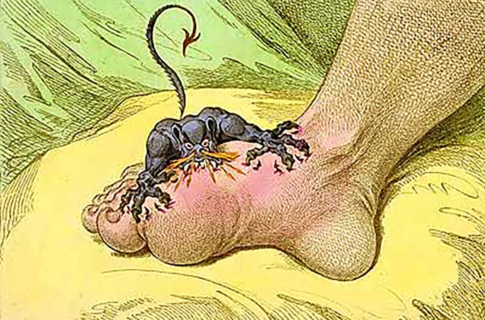 James Gillrays Illustation 'The Gout'