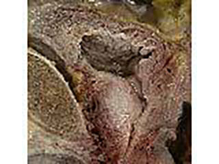 Photo Of The Prostate Gland