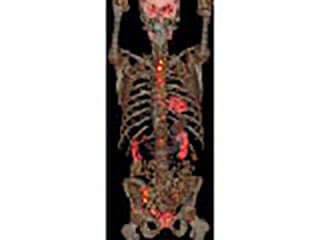 Picture Of A Body Scan