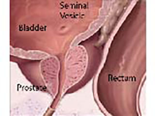 Picture Showing The Prostate Gland Below The Bladder