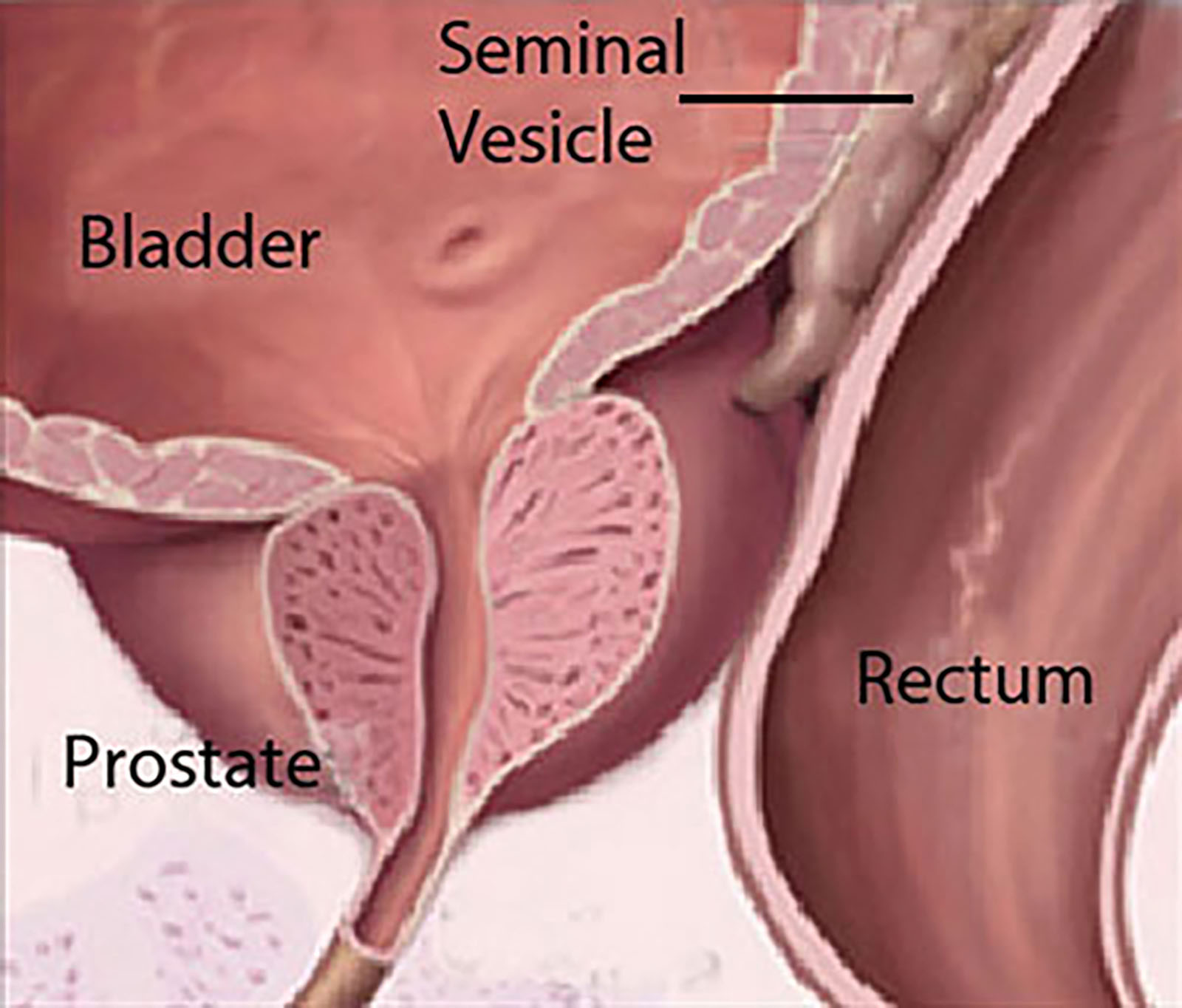 Diagram Showing The Prostate Gland Below The Bladder