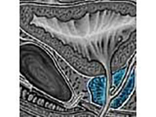 Picture Of An Image Scan Of A Healthy Prostate Gland