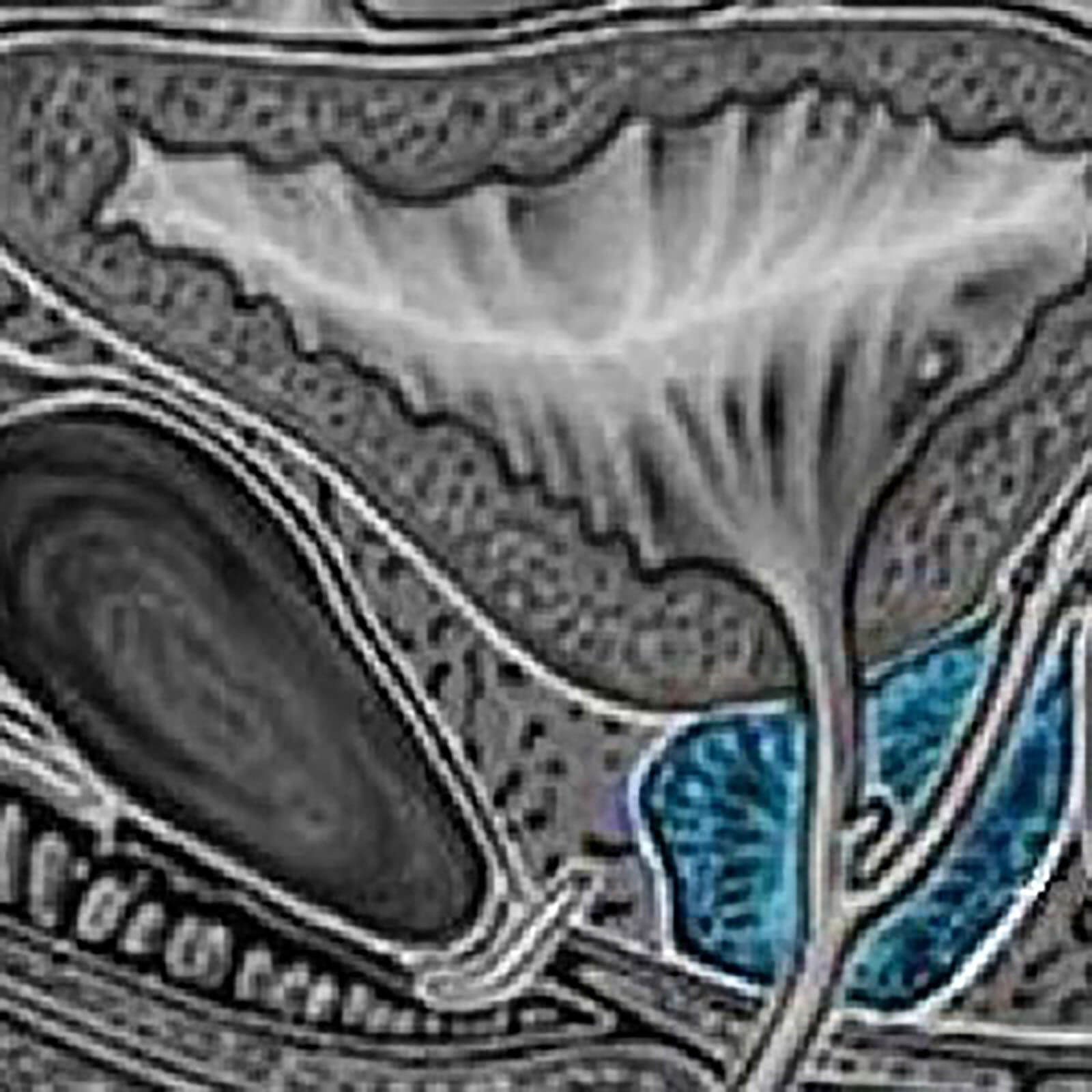 Normal Sized Prostate Gland