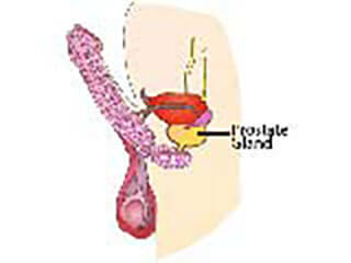 Picture Showing The Prostate Gland