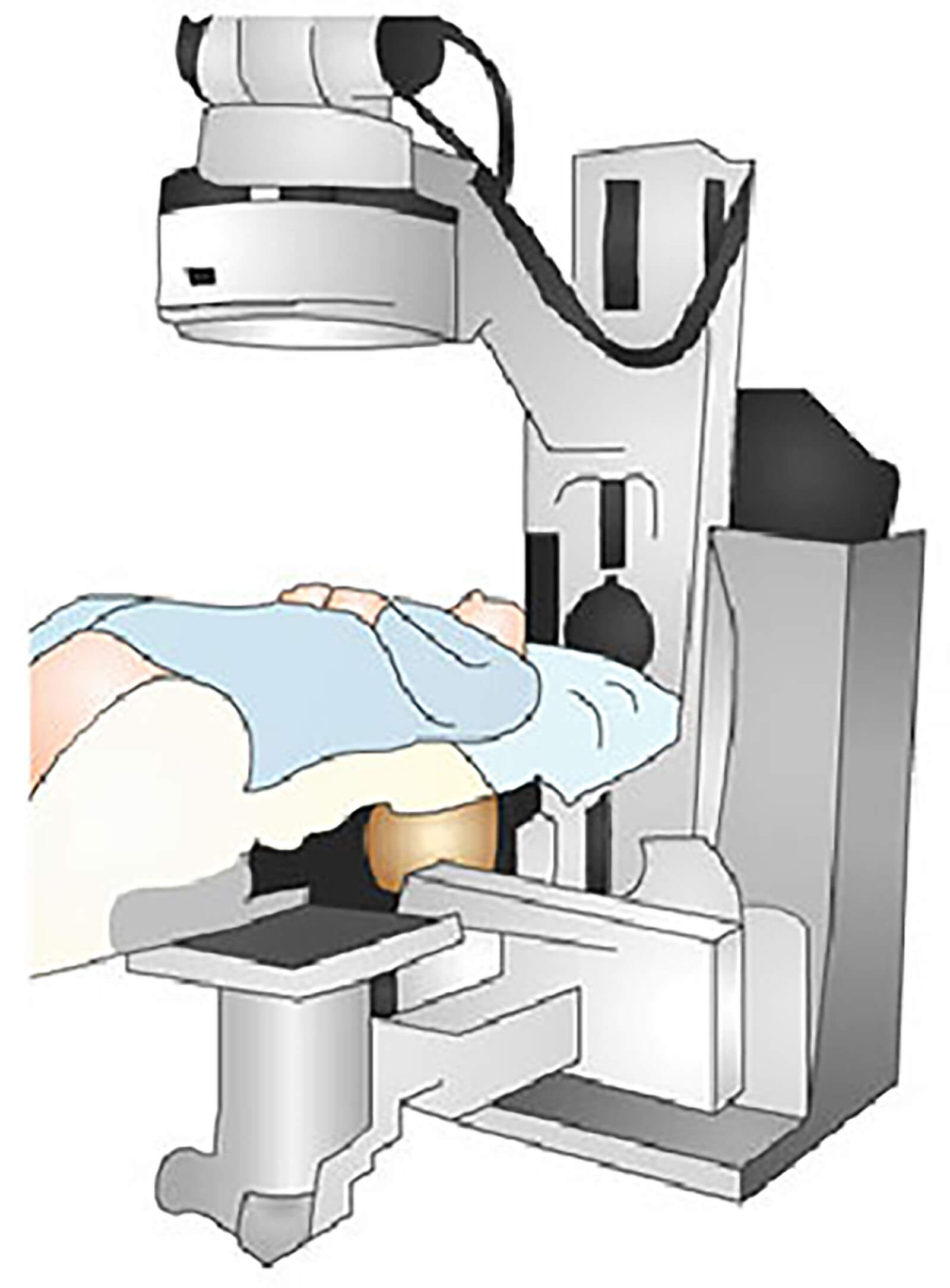 Radiology For Prostate Cancer Patient Being Given Radiology